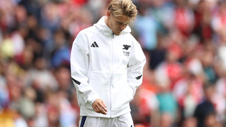 Arsenal captain Martin Odegaard has sustained ’vital’ ankle ligament injury