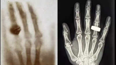 SpaceX’s Fram2 mission achieves first-ever human X-Ray in space orbit | SpaceX’s Fram2 mission achieves first-ever human X-Ray in space orbit |